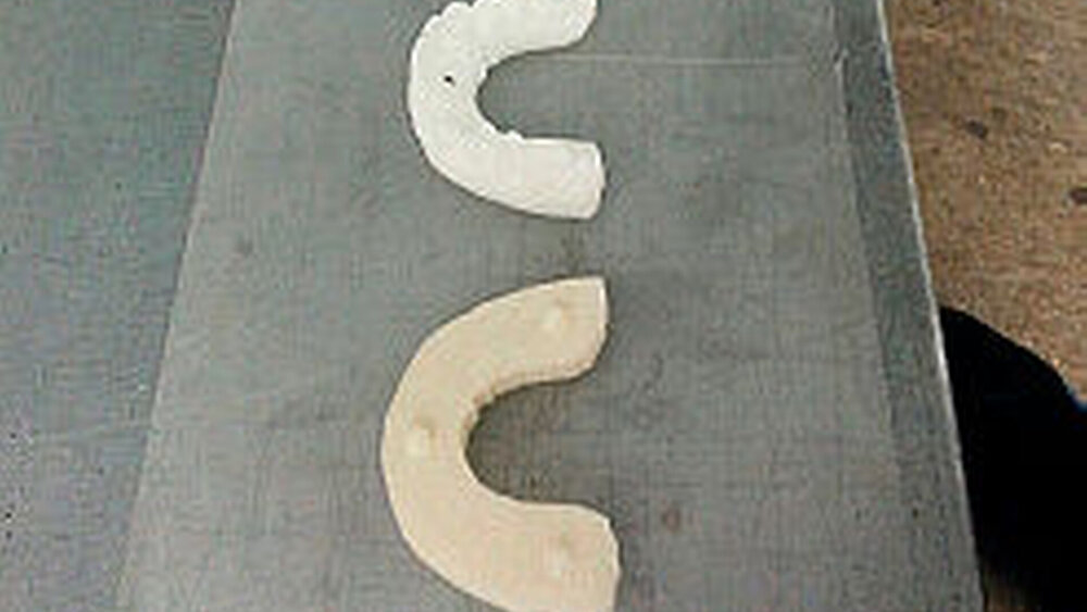 6. Die Aligner-Stufen kommen aus dem Drucker. Die Beschriftung der Stücke ist entscheidend, „und das war gar nicht so einfach, denn sie sehen ja fast identisch aus“, meint Dudley. |