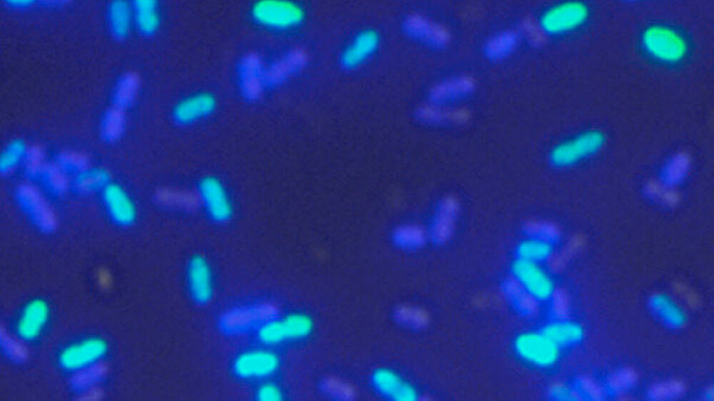 Streptococcus mutans: Wenn wir genau wissen, wie der Erreger überlebt und in seiner natürlichen Umgebung agiert, können wir auch Strategien entwickeln, wie wir seine Ausbreitung vermindern, sagen die Forscher.