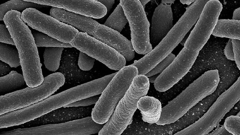 Das stäbchenförmige Escherichia coli-Bakterium kann schwere Infektionen verursachen (rasterelektronenmikroskopische Aufnahme).
