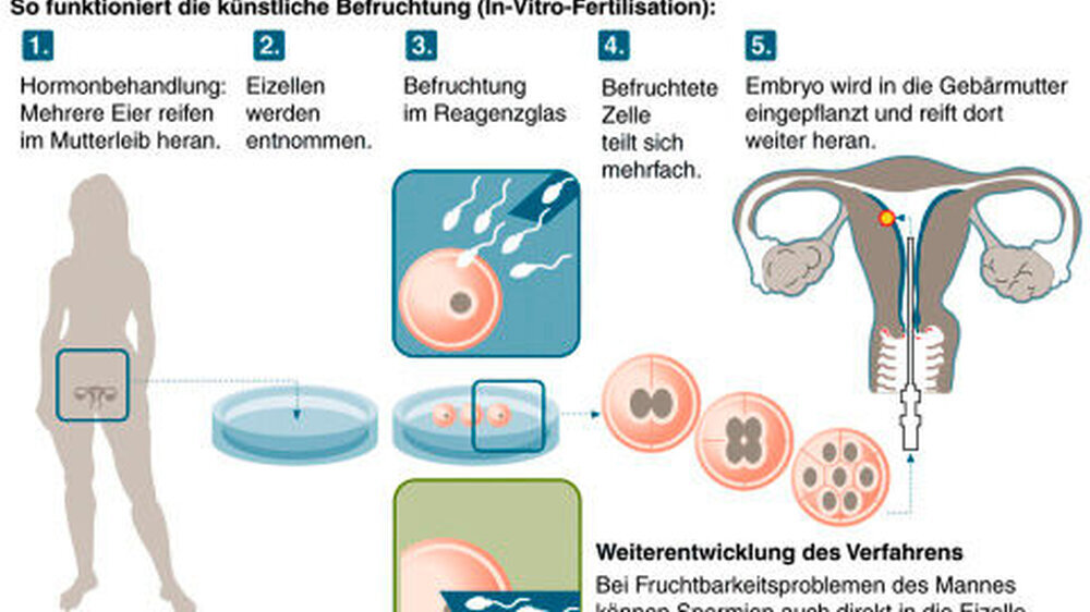Beim Social Freezing friert man die Eizellen nach der Entnahme ein, bei Bedarf werden sie aufgetaut und eingesetzt. Das Verfahren ist im Grunde nichts anderes als eine künstliche Befruchtung mit jung gehaltenen Eizellen.
