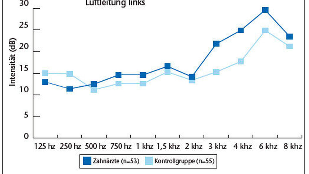 Grafik 1b: Ergebnisse der audiometrischen Tests für die Luftleitung zum linken Ohr |