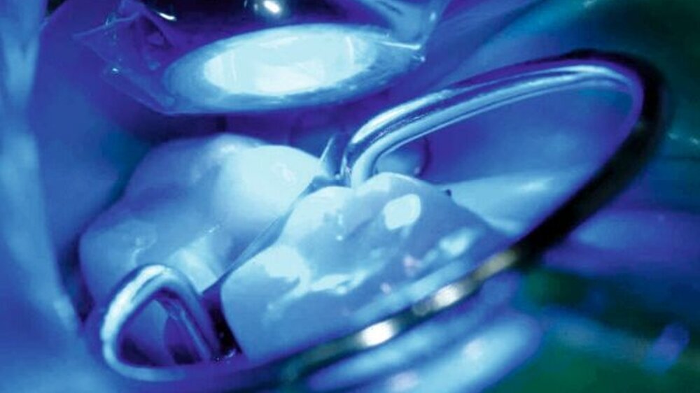 Einsatz eines LED-Lichtgeräts