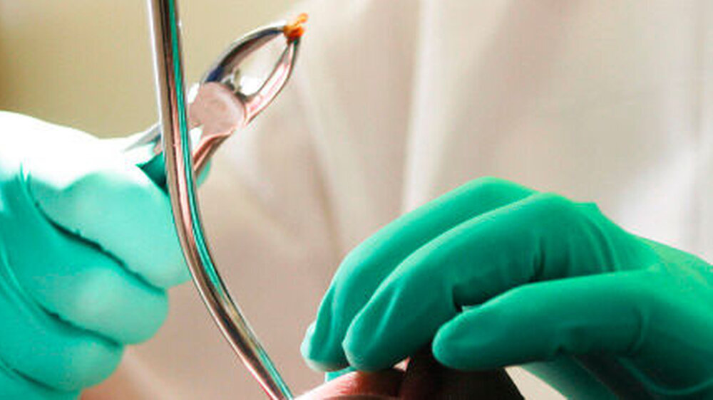 Extraktionen gehören zur zahnärztlichen Routine. Bei dem Patienten, von dem dieser Fallbericht handelt, sah die Situation leider anders aus, ...\r\n