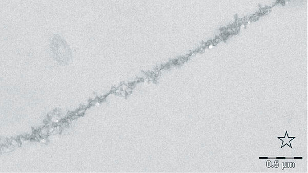 Abbildung 1a: transelektronenmikroskopische Darstellung der physiologischen Pellikel nach 30 Minuten ohne Spülung