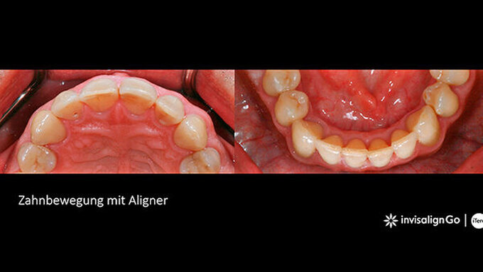 128709-flexible-1900.jpg 128709-flexible-1900.jpg