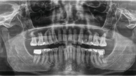463866-flexible-1900 463866-flexible-1900