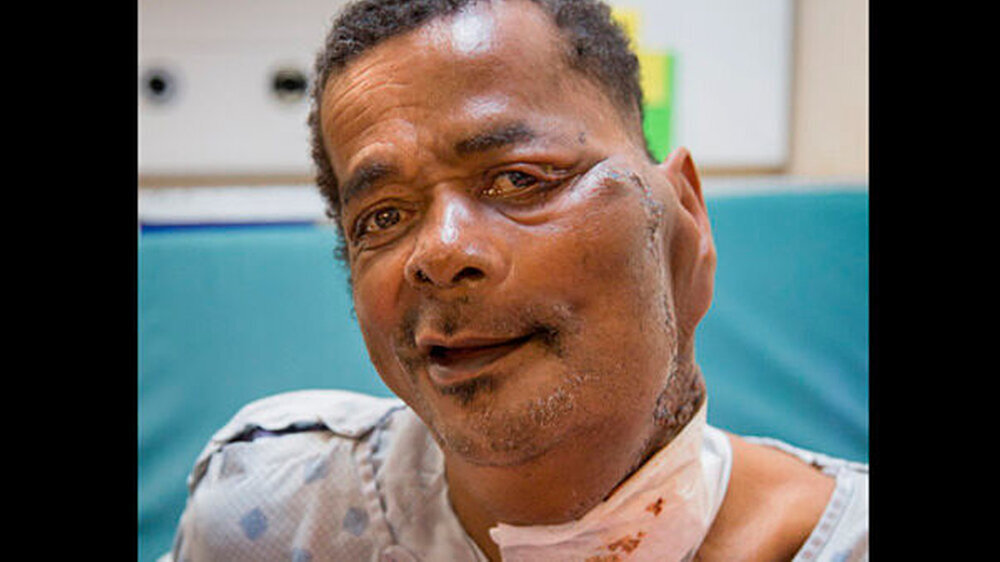 Der Patient unmittelbar nach der Operation.