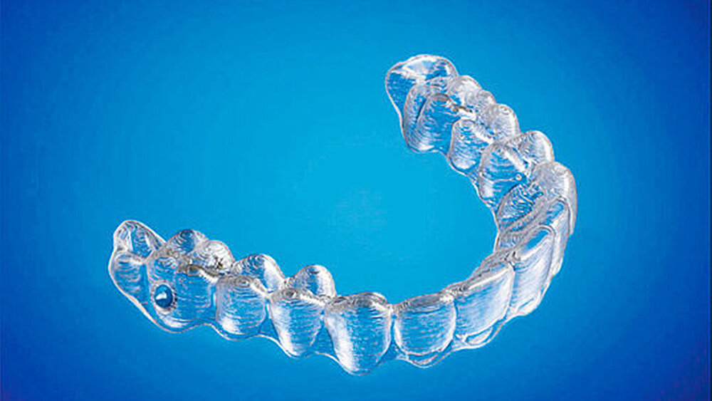 1. Im Zuge seiner studentischen Forschungsarbeit sei er über dieses Bild einer durchsichtigen Zahnschiene gestolpert – und entdeckte, dass die Rillen im Modell wie bei einem 3-D-Druck aussehen! Und was, bitte schön, sollte ihn – bis auf den normalen Instinkt zur Selbsterhaltung – daran hindern, sich selbst eine Aligner-Schiene zu basteln? Genau: gar nichts. Nach umfangreichen Recherchen weiß er, was man braucht: Kenntnisse der orthodontischen Bewegungen, einen 3-D-Scanner, einen Zahnabdruck, CAD-Software, einen 3-D-Drucker, Retainer-Material und eine Vakuumformmaschine. Dudley: „Ich hatte all diese Dinge – oder konnte sie kaufen.“ |