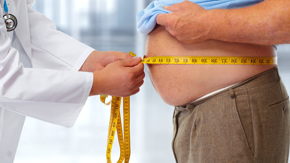 Doctor measuring obese man stomach. Adipositas