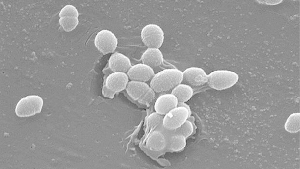 Sekundäre endodontische Infektionen haben offensichtlich eine heterogene Ätiologie, bei der keine einzelne Spezies als der hauptsächliche endodontische Erreger fungiert. E. faecalis (im Bild) und P. gingivalis überwogen in allen Phasen der endodontisc