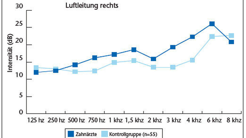 Grafik 1a: Ergebnisse der audiometrischen Tests für die Luftleitung zum rechten Ohr |