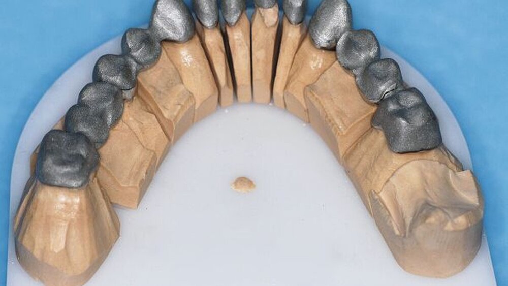 Abbildungen 13a, 13b, 13c: Gerüste (Nichtedelmetalllegierung). |