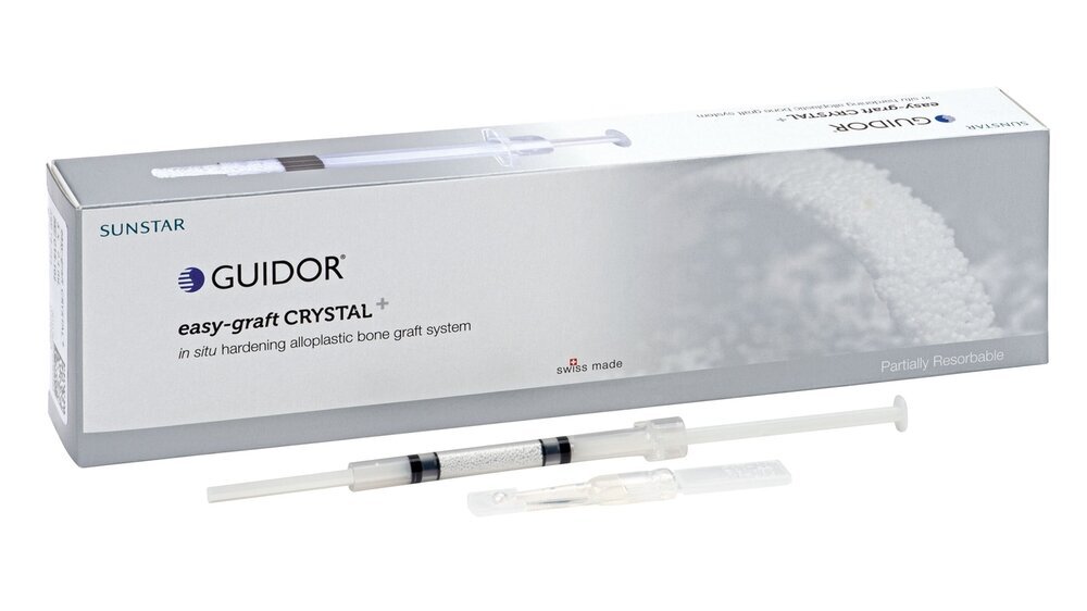 Die einfache Anmischung und Handhabung ist nur einer der Vorteile des KEM GUIDOR easy-graft von Sunstar.