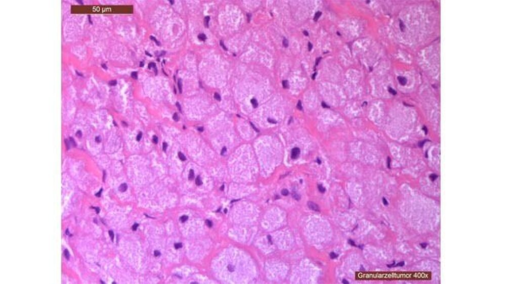 Abbildung 4: Histologisch aufbereitetes Präparat in H.E.-Färbung in einer großen Vergrößerung.