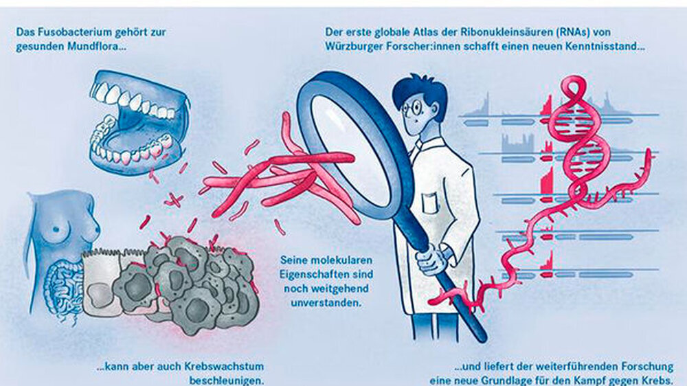 Fusobakterien kommen auch bei gesunden Menschen im oralen Mikrobiom vor. Sie sind aber auch an anderen Stellen im Körper nachweisbar und fördern dort das Tumorwachstum, etwa im Darm und in der Brust.