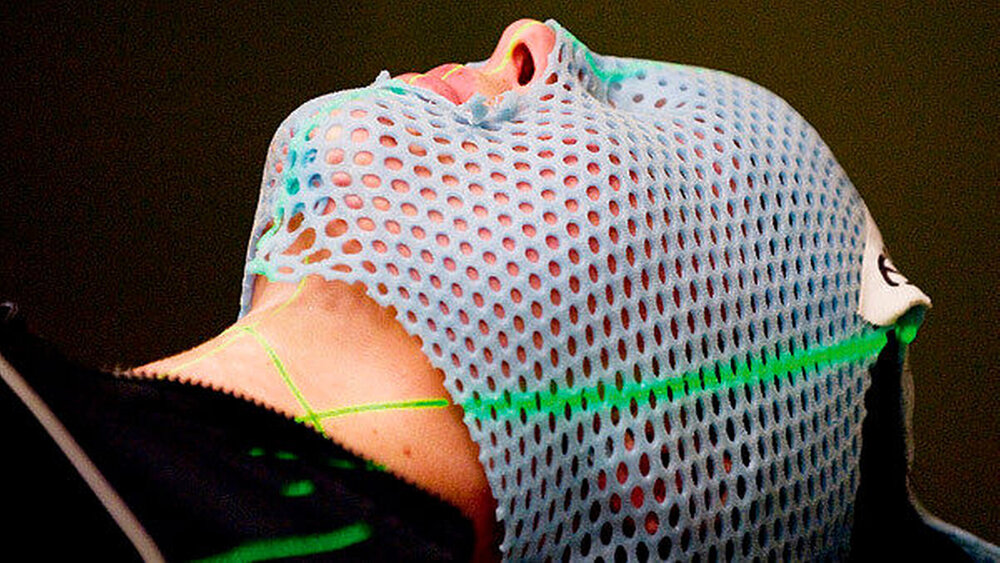 Ziel der Radiotherapie ist es, durch den Einsatz ionisierender Strahlung den Tumor in seinem gesamten Ausbreitungsgebiet zum Absterben zu bringen und dabei das umgebende gesunde Gewebe möglichst nicht zu beeinträchtigen. Mit einer starren Maske wird dazu der Kopf des Patienten für die Dauer der Bestrahlung am Bestrahlungstisch fixiert. |