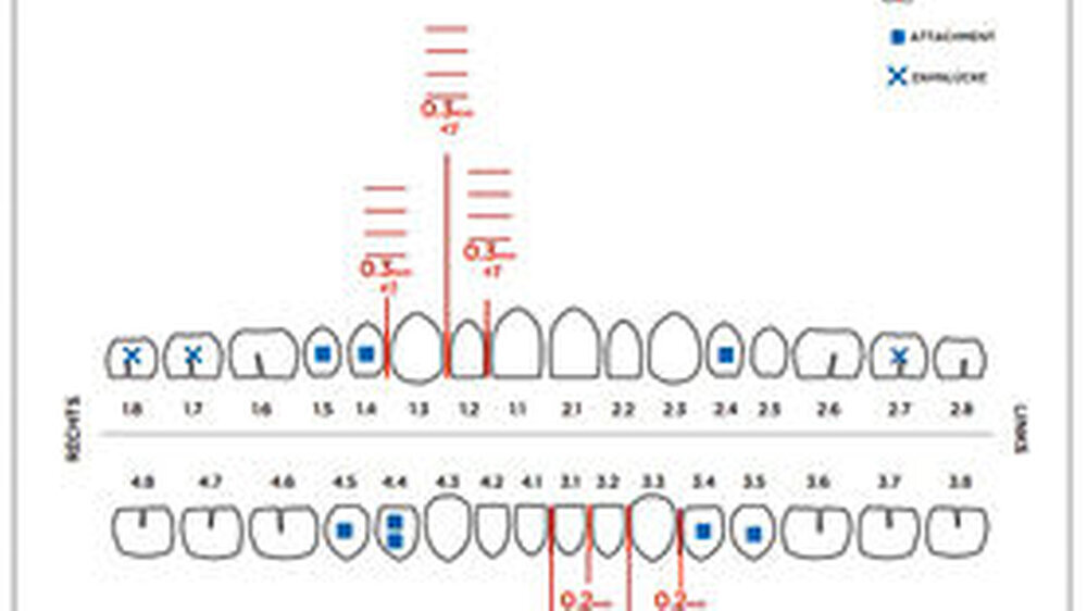 Abbildung 7: Behandlungsanforderungen Invisalign Abbildung 7: Behandlungsanforderungen Invisalign
