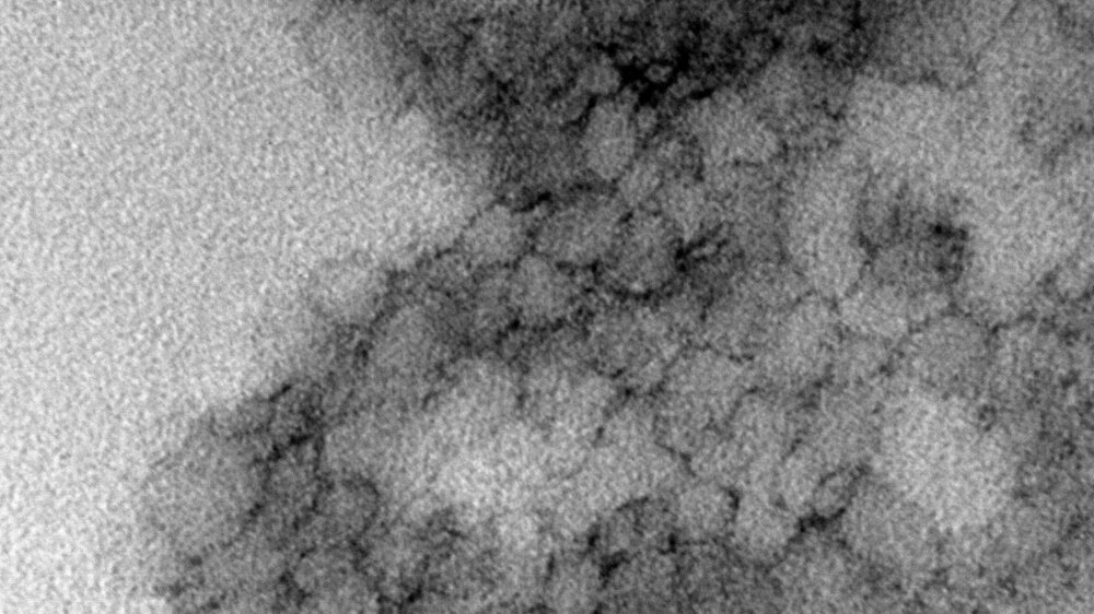 Eine Elektronenmikroskop-Aufnahme aus der Studie zeigt das problematische Peptid 33-mer-DGP mit stacheligen Strukturen, die die Darmbarriere öffnen können.