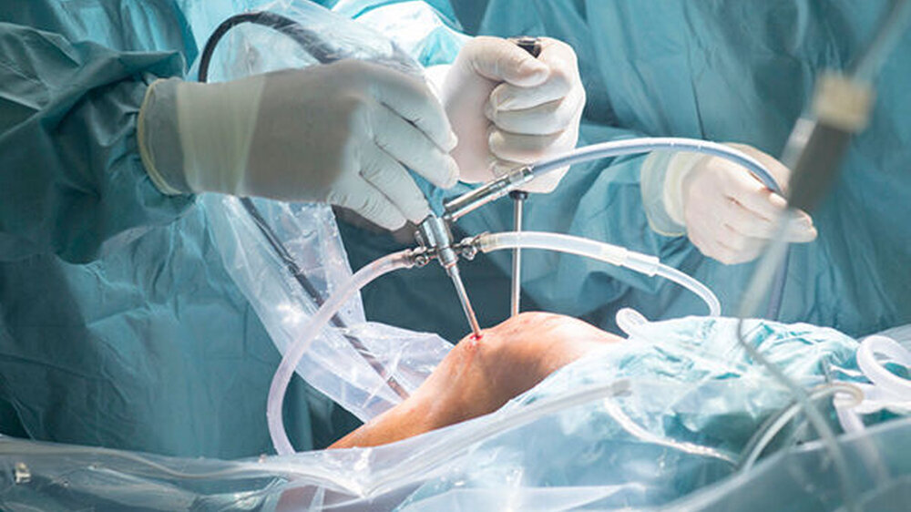 Die häufigsten Diagnosen, die zu Behandlungsfehlervorwürfen führten, waren Knie- und Hüftgelenksarthrosen sowie Unterschenkel- und Sprunggelenkfrakturen.