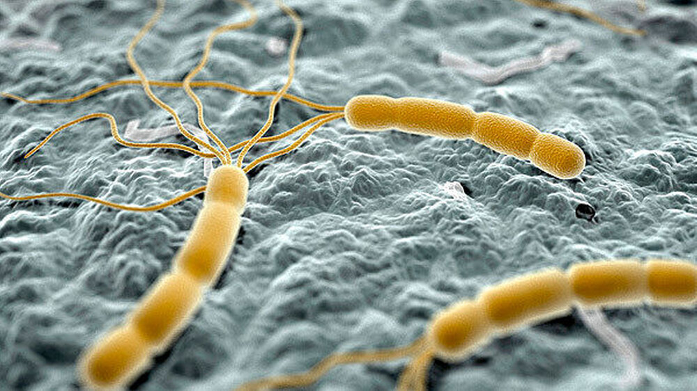 Helicobacter pylori ist verantwortlich für Geschwüre im Magen und im Zwölffingerdarm. Die Frage ist: Wie gelangt der Keim in die Mundhöhle? | Helicobacter pylori ist verantwortlich für Geschwüre im Magen und im Zwölffingerdarm. Die Frage ist: Wie gelangt der Keim in die Mundhöhle? |
