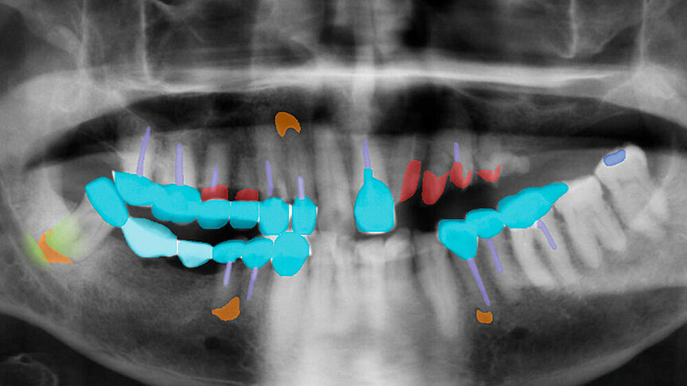 Ein Bild allein ist noch keine Diagnose. Künstliche Intelligenz wird die klinische Untersuchung nicht ersetzen können. \r\n\r\n