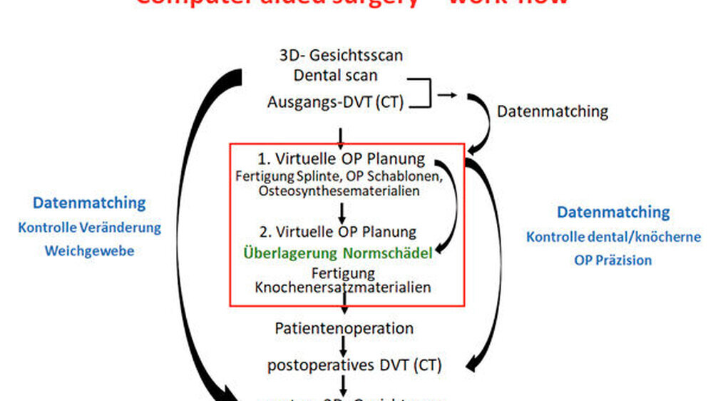 Abb. 1: Schema der computer assisted surgery (CAS)