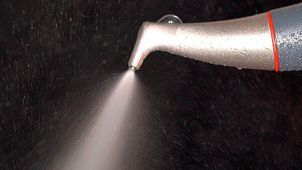 Abbildung 1: Pulverstrahlkegel bei normaler klinischer Anwendung. Im Gegenlicht sind Streubreite des Kegels und die Tropfen- beziehungsweise die Aerosolbildung gut zu erkennen. |