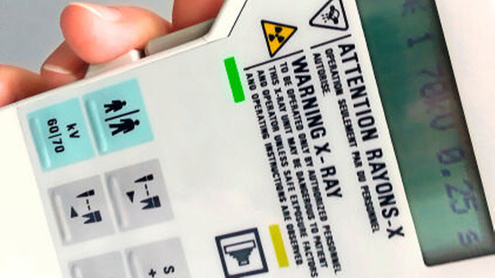 Röntgenaufnahmen sind ein unverzichtbares Instrument in der zahnärztlichen Diagnostik.