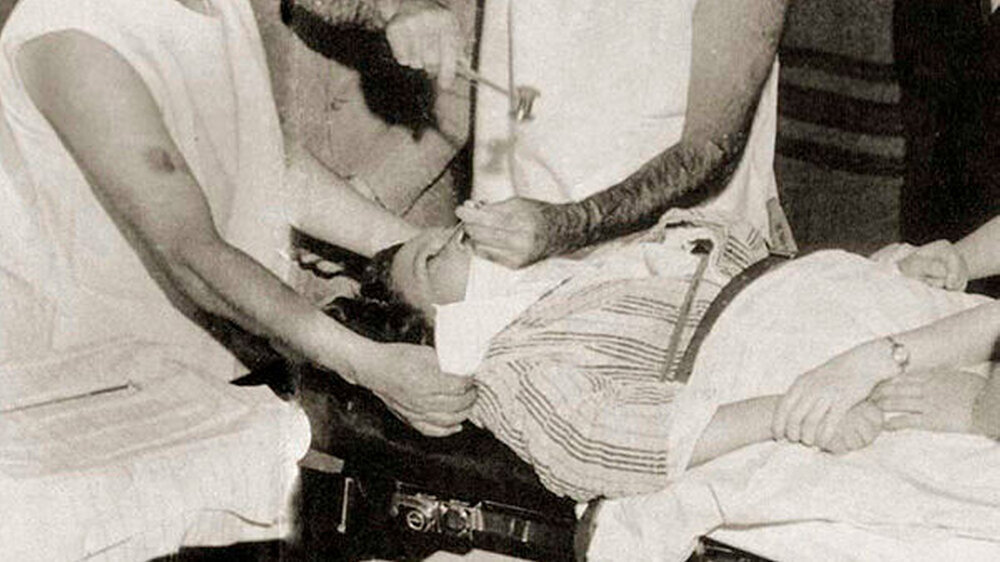 Eine Lobotomie, durchgeführt von Walter Freeman. Er trepanierte dabei die Schädeldecke des Patienten und durchtrennte mit einem Schneidewerkzeug die Nervenbahnen zwischen Stirnlappen und Thalamus. Im Endeffekt zerstörte er die präfrontale Gehirnregion