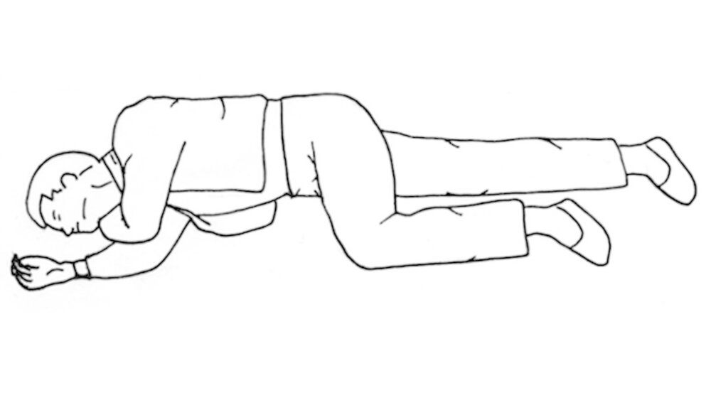 Abbildung 2: Stabile Seitenlage |