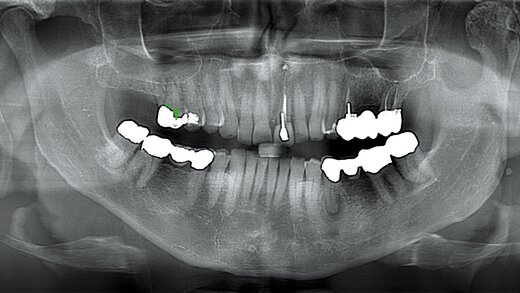 556735-flexible-1900 556735-flexible-1900