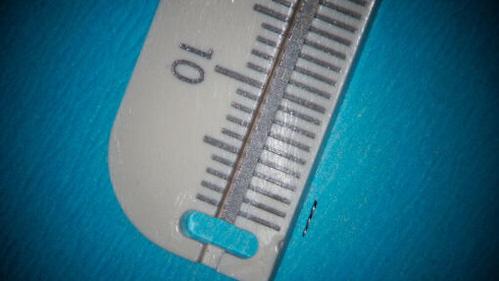 Abbildung 3: Geborgene Instrumentenspitze der S1-Feile von 3 mm Länge |