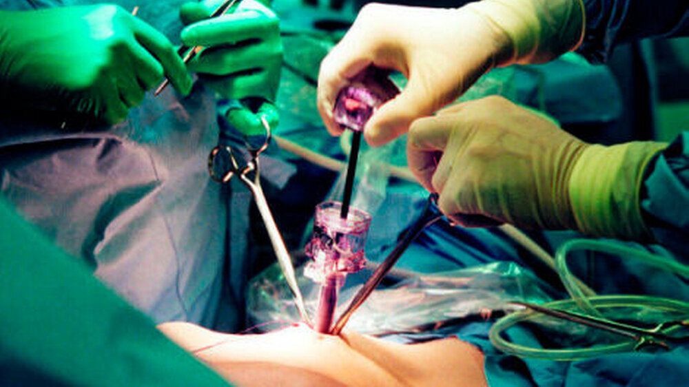 Immer mehr minimalinvasive\r\nOperationen\r\nwerden ambulant\r\ndurchgeführt; dies\r\nbedingt ein Optimum\r\nder Versorgungsstrukturen.