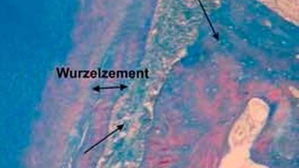 Abbildung 1:\r\nRegenerationselemente des humanen Parodonts (Human-Präparatesammlung, Prof. Dr. Arnold)