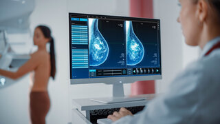 Mammografie Screening