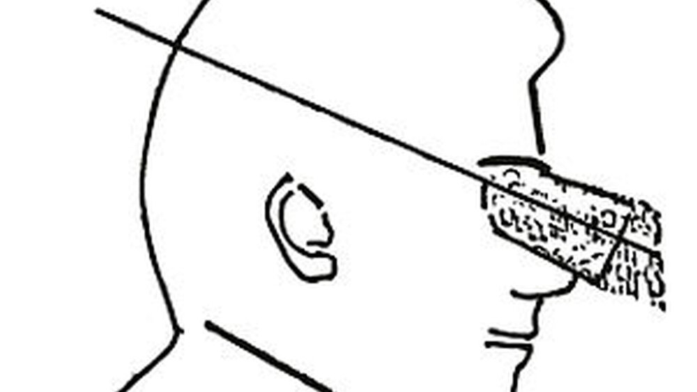 Abbildung 5: Die Okularachse richtet sich nach dem Sehachsenwinkel bei Kopfbewegungen im oberen Kopfgelenk. |