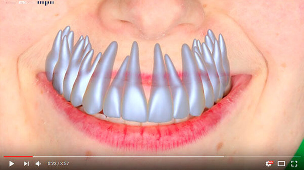 Die Forscher schufen zuerst eine Vorlage, indem sie mithilfe von hochauflösenden 3-D-Scans von 86 verschiedenen Zahnreihen entwickelten. Aus diesen Daten erstellten sie ein Modell einer durchschnittlichen Zahnreihe und berechneten die natürliche Variati