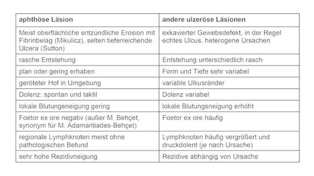 Übersicht 1: Morphologie und Klinik zur Unterscheidung aphthöser und anderer ulzeröser Läsionen