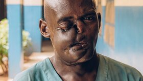 Dahiru Saidu,32, is a former patient of the Noma Hospital in Sokoto, Nigeria. To make a living, he has three different jobs: farmer on the outskirts of Sokoto, car washer and cleaner at the Noma Hospital. Sokoto, Nigeria, May 6, 2023.
