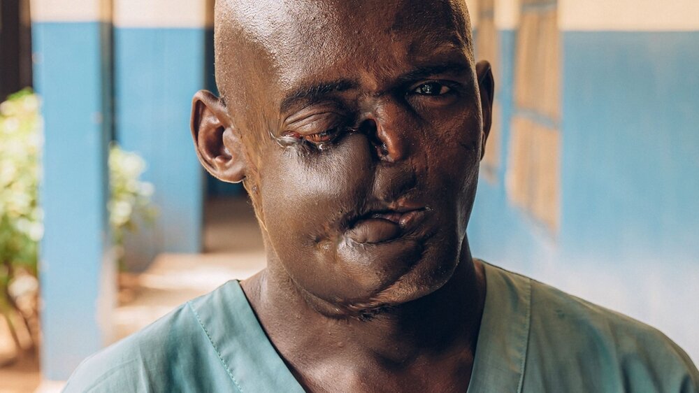 Dahiru Saidu,32, is a former patient of the Noma Hospital in Sokoto, Nigeria. To make a living, he has three different jobs: farmer on the outskirts of Sokoto, car washer and cleaner at the Noma Hospital. Sokoto, Nigeria, May 6, 2023.