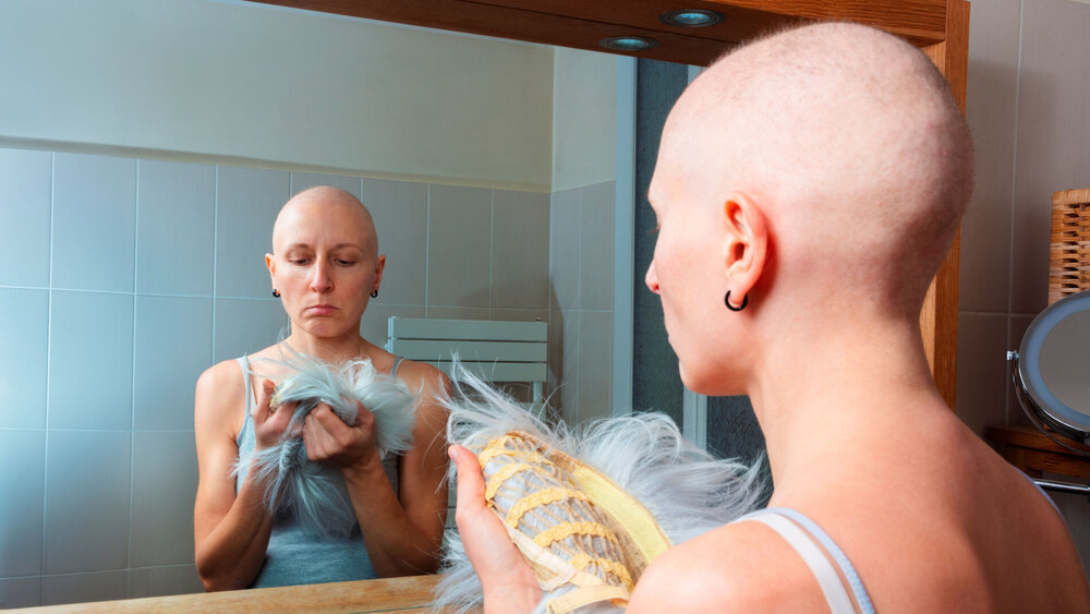 Haarlose Krebspatientin steht mit Perücke in der Hand vor einem Spiegel