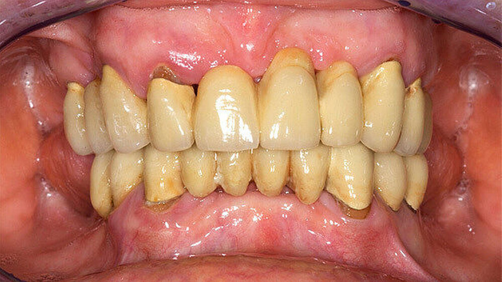 Stabiler Zustand trotz suboptimaler Hygiene und Compliance. |