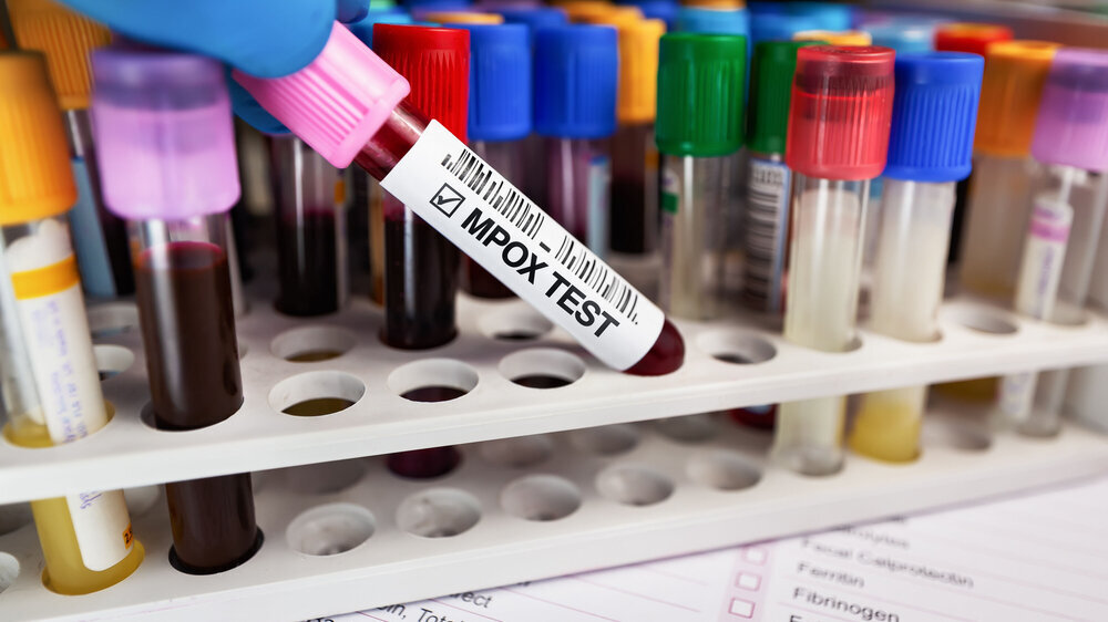 MpoX-Test im Labor: Blutröhrchen mit Scann Code Etikett. MpoX-Test im Labor: Blutröhrchen mit Scann Code Etikett.
