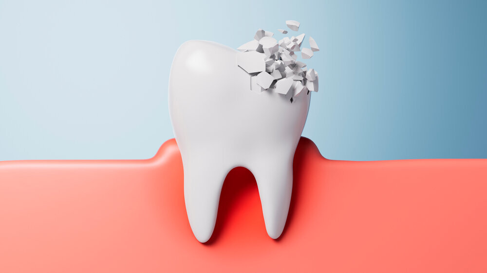 Prävention Mundgesundheit Schaden Zahnschmerzen