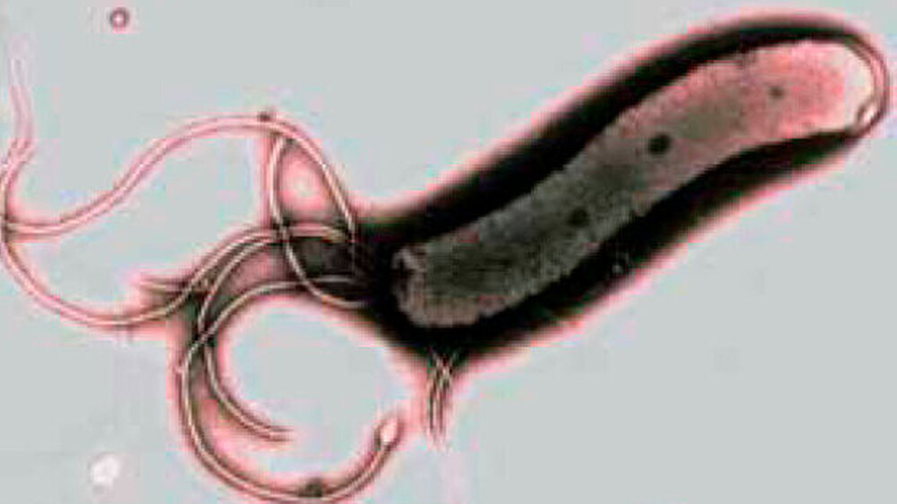 Helicobacter pylori