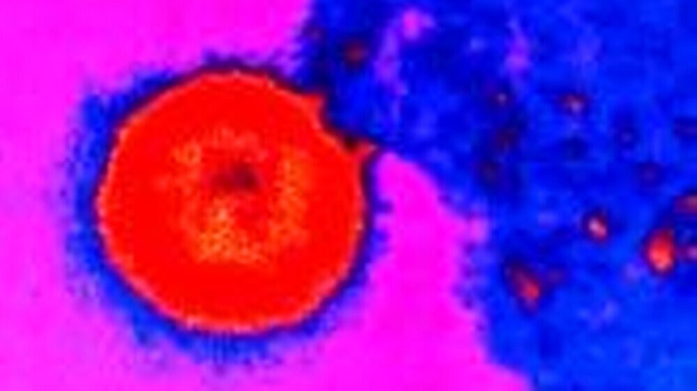 Das HI-Virus hat viele Gesichter.