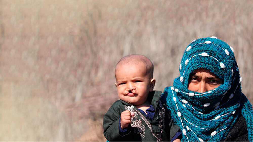 In Afghanistan werden pro Jahr rund 2.500 Kinder mit Lippen-Kiefer-Gaumenspalte geboren.