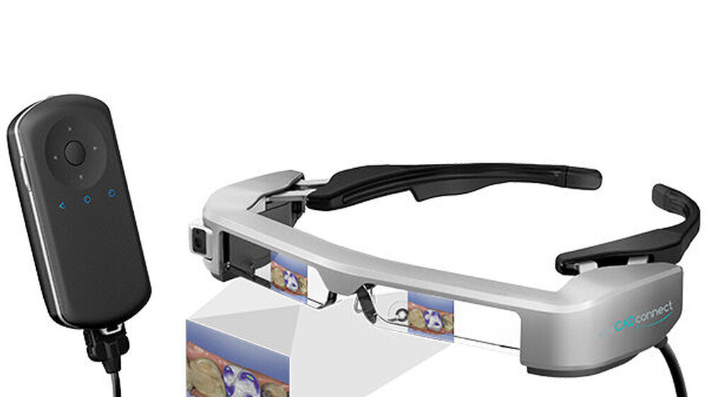 Das eyeCADconnect-System unterstützt den Zahnarzt beim digitalen Abformen mit dem Intraoralscanner - mit dem Ergebnis exakter, schnellerer und effizienterer Scans.