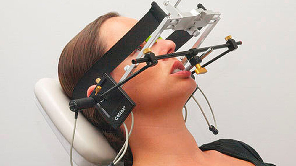 Abbildung 1: Beispiel für ein gelenknah und berührungshaft messendes System zur Bewegungsaufzeichnung des Unterkiefers (hier: Cadiax compact, Fa. Gamma Dental, mit Artex Gesichts- bogen, Fa. Ammann Girrbach). | Abbildung 1: Beispiel für ein gelenknah und berührungshaft messendes System zur Bewegungsaufzeichnung des Unterkiefers (hier: Cadiax compact, Fa. Gamma Dental, mit Artex Gesichts- bogen, Fa. Ammann Girrbach). |