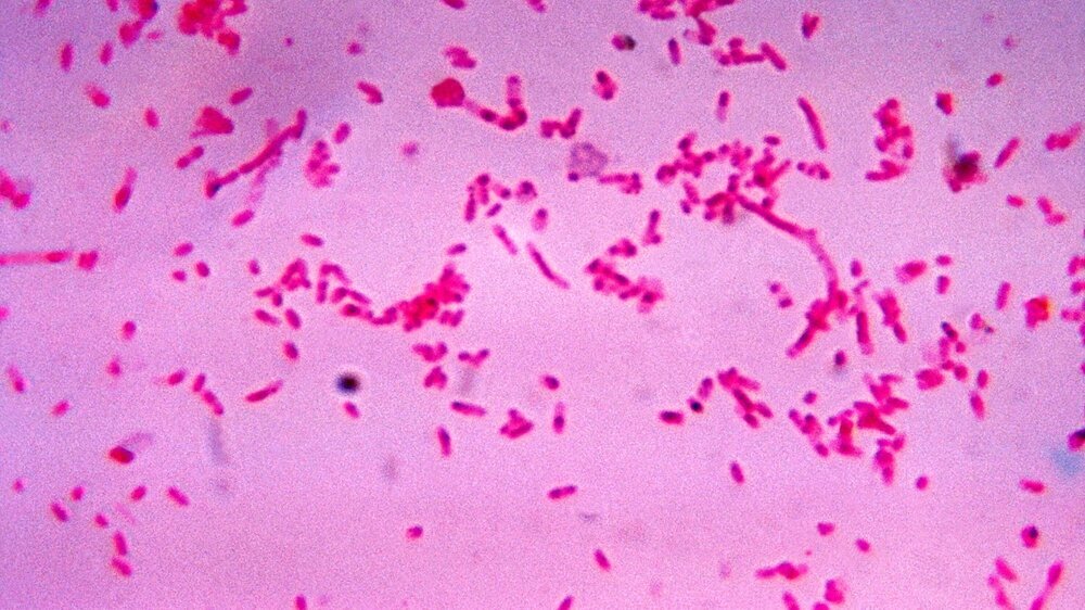 Fusobacterium novum in Flüssigkultur Fusobacterium novum in Flüssigkultur